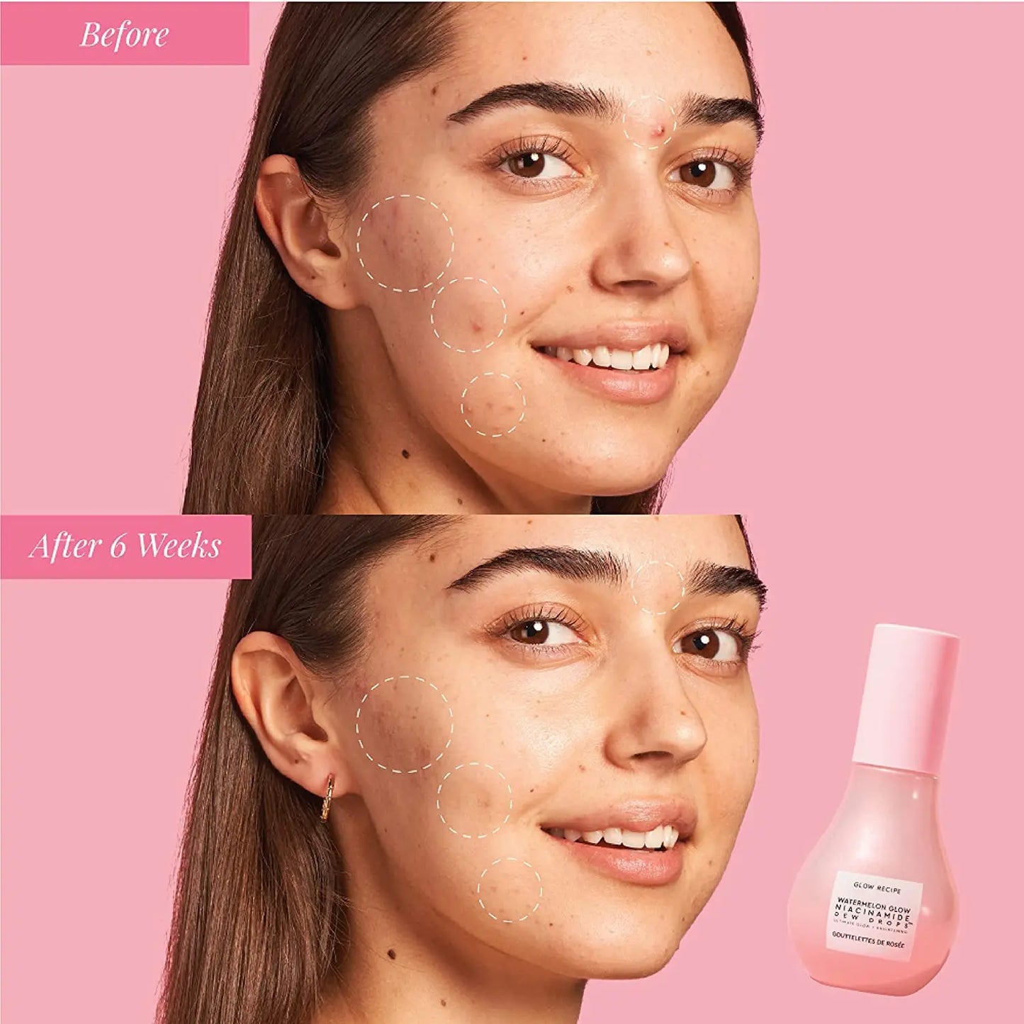 Glow Recette Niacinamide WaterNeutrGlow Gouttes de Rosée, Élimination de la Pigmentation, Sérum Éclaircissant pour le Visage et le Corps, 40ml