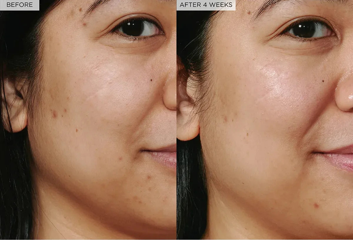 Glow Recette Niacinamide WaterNeutrGlow Gouttes de Rosée, Élimination de la Pigmentation, Sérum Éclaircissant pour le Visage et le Corps, 40ml
