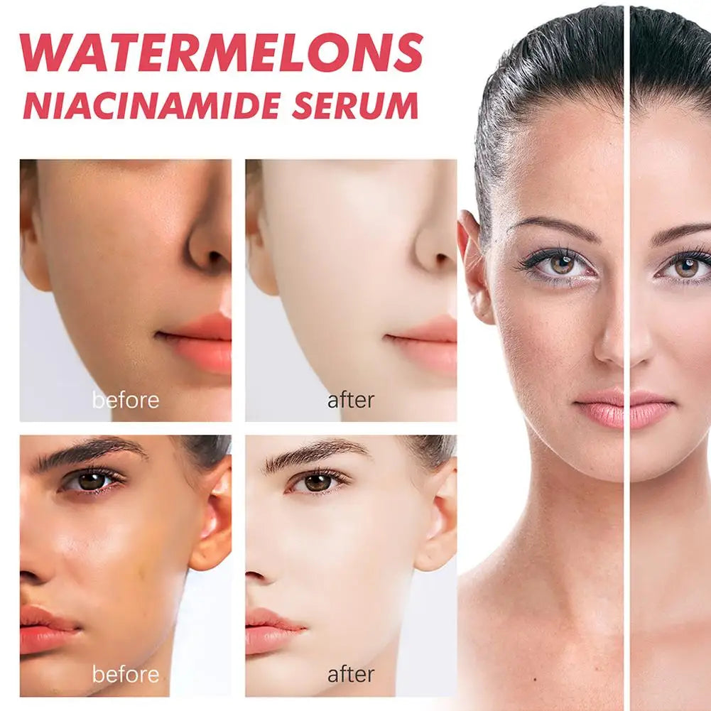 Gouttes de rosée Niacinamide, recette lumineuse de pastèque, 40ML, pour la peau lisse, hydratante, avec soin de la peau à l'acide hyaluronique