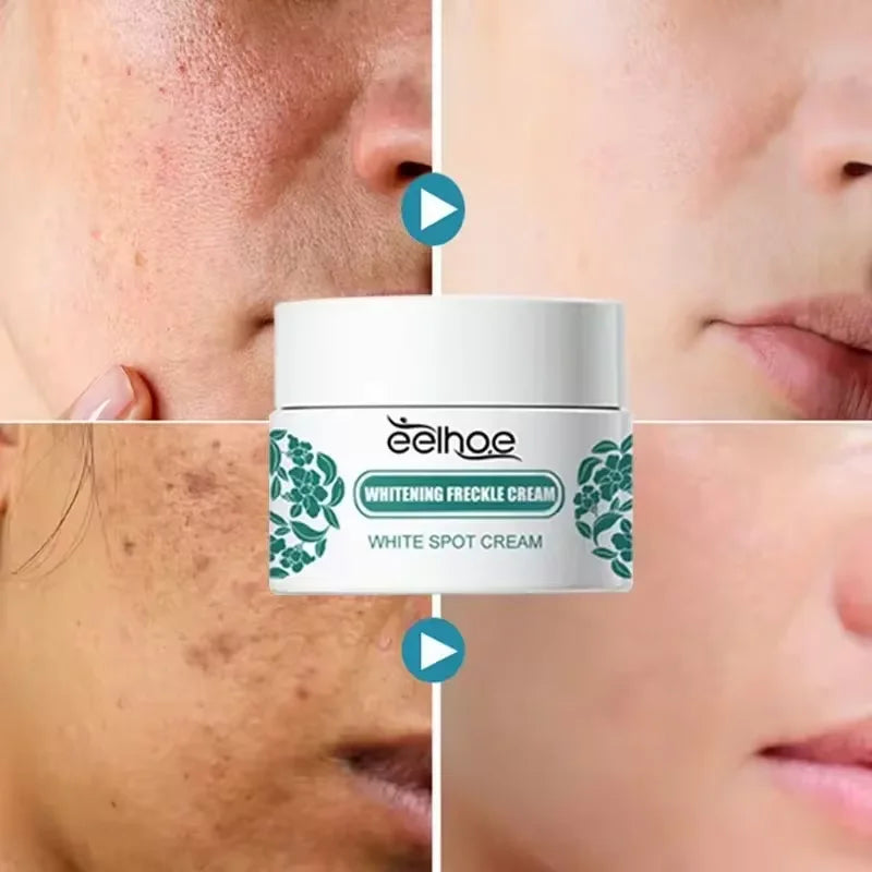 Crème visage éclaircissante – Taches, mélasma & anti-âge