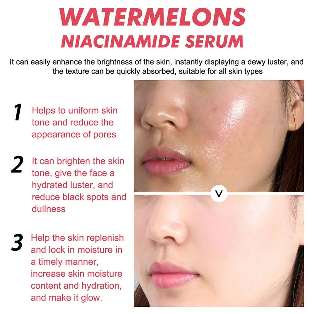 Gouttes de rosée Niacinamide, recette lumineuse de pastèque, 40ML, pour la peau lisse, hydratante, avec soin de la peau à l'acide hyaluronique