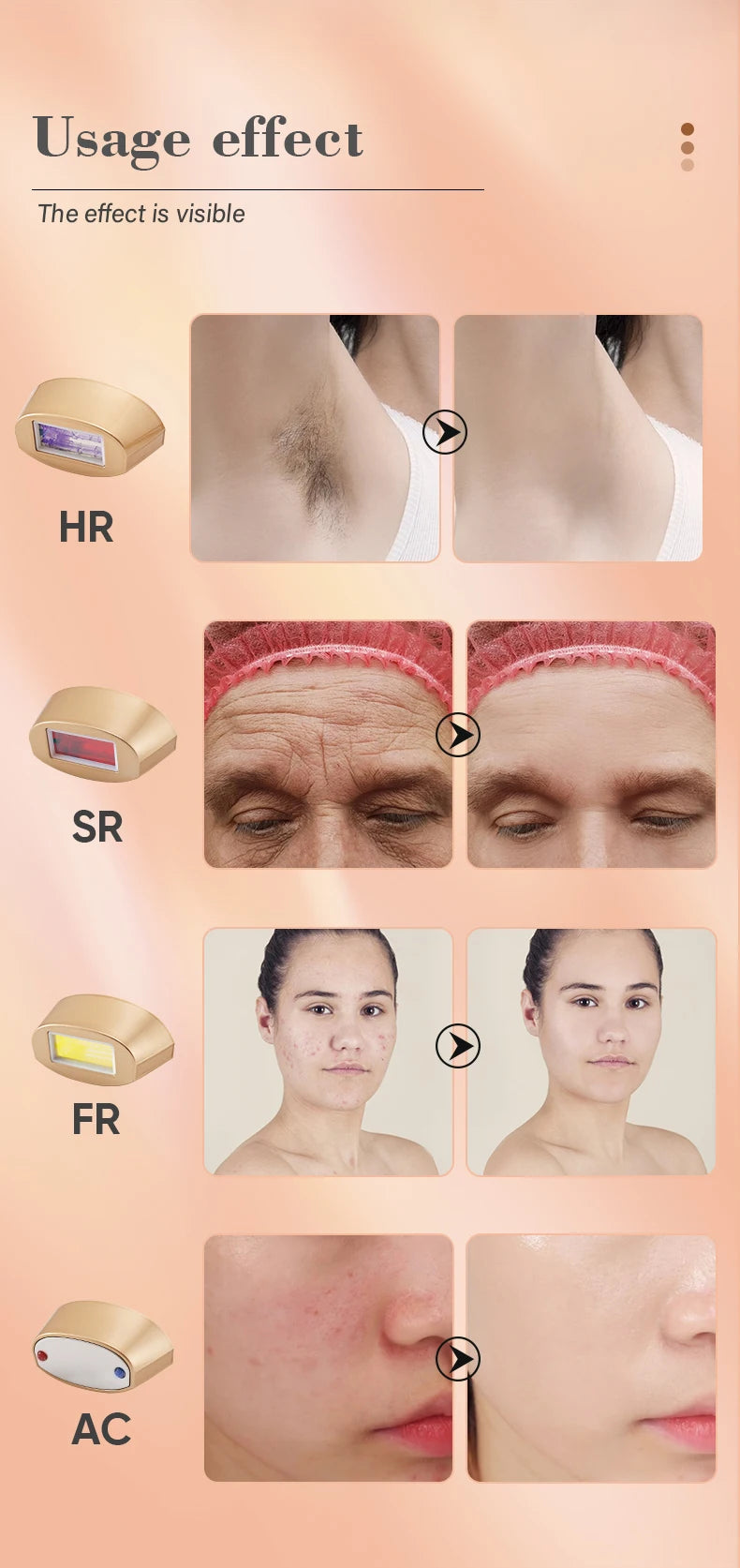 KODO 2025 – Épilateur laser IPL 4-en-1 indolore visage & corps