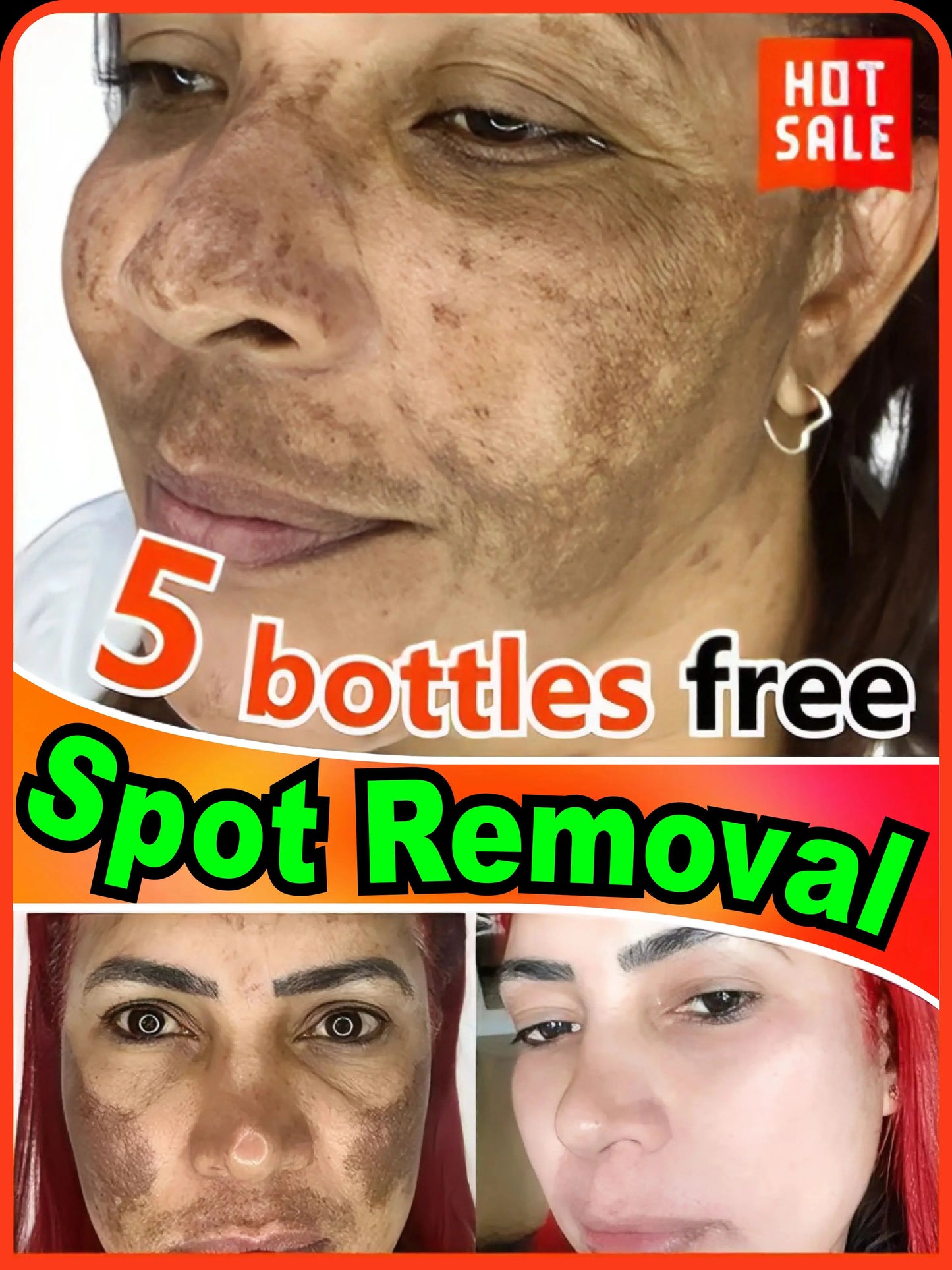 Toral Sérum Anti-Taches – Cible et Corrige Tous les Types de Pigmentation