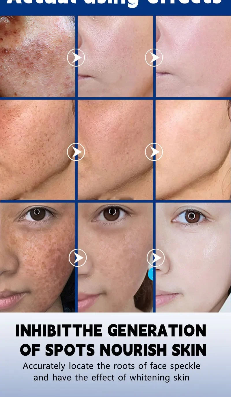 Toral Sérum Anti-Taches – Cible et Corrige Tous les Types de Pigmentation