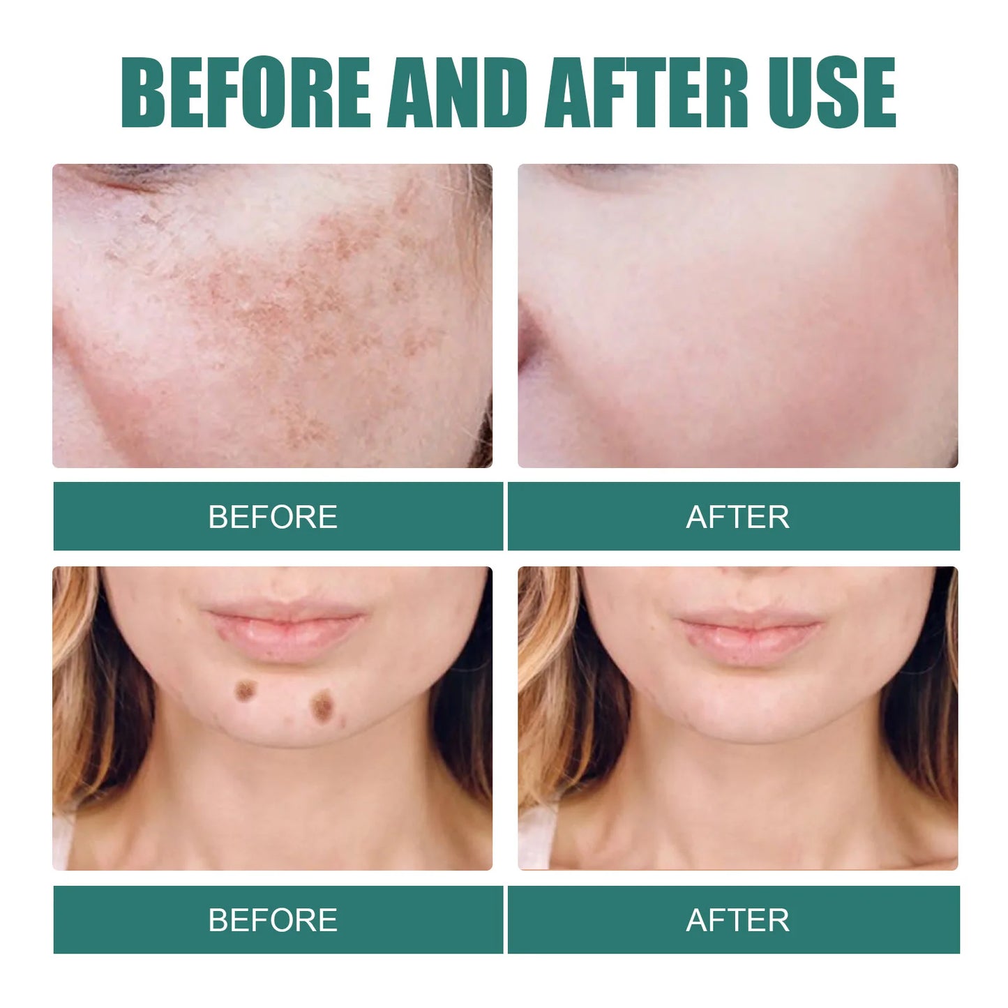 Crème visage éclaircissante – Taches, mélasma & anti-âge