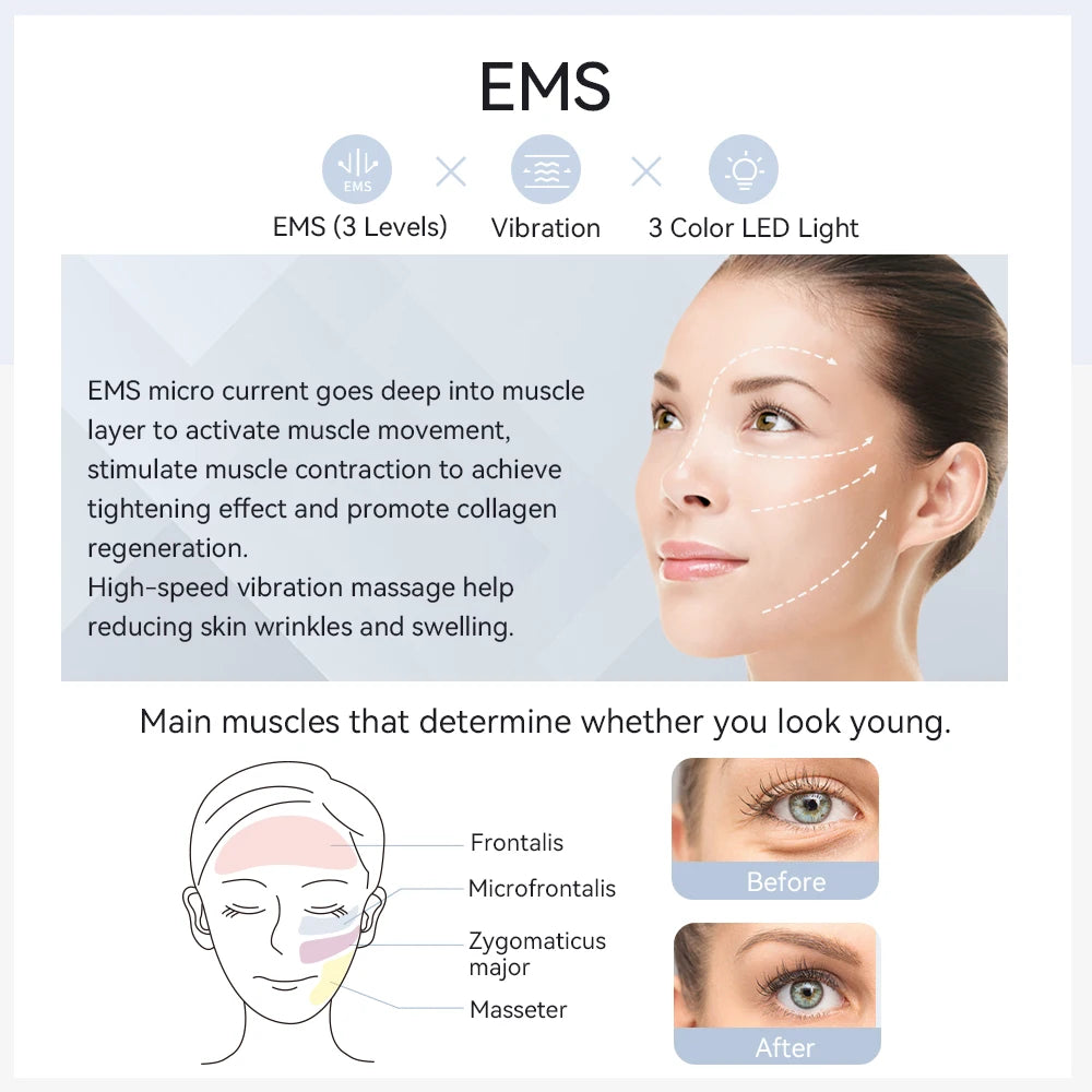 ANLAN Ohio EMS Pro – Lifting visage, rajeunissement, compresses chaud/froid
