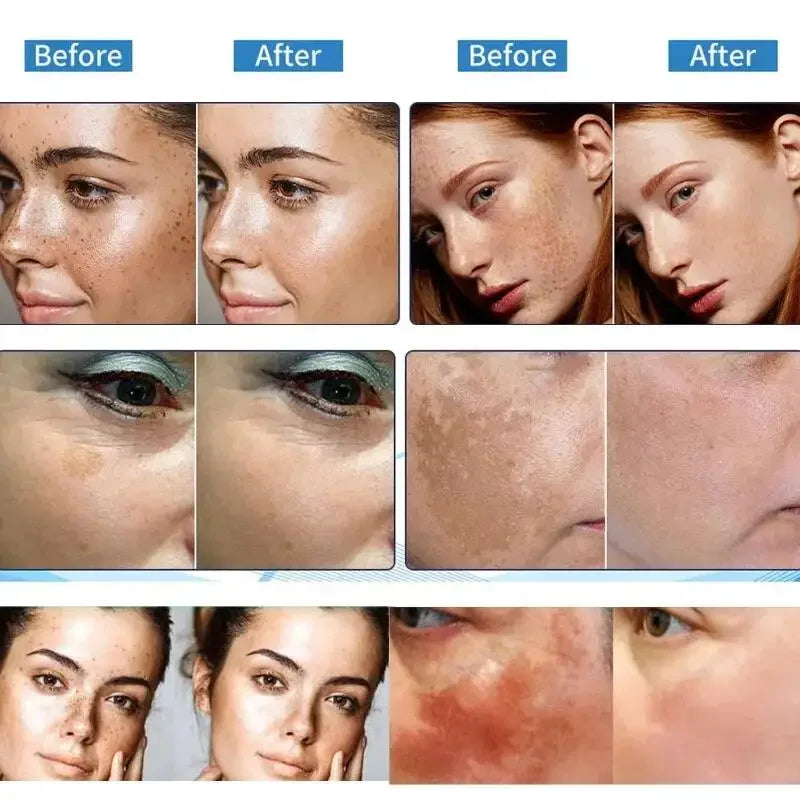 Crème visage éclaircissante – Taches, mélasma & anti-âge