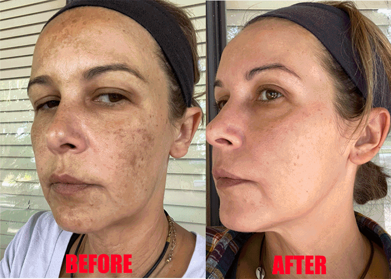 Crème visage éclaircissante – Taches, mélasma & anti-âge