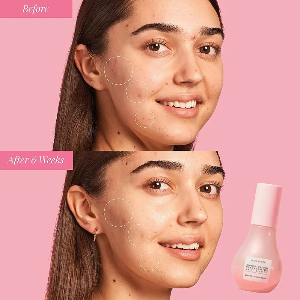 Gouttes de rosée Niacinamide, recette lumineuse de pastèque, 40ML, pour la peau lisse, hydratante, avec soin de la peau à l'acide hyaluronique