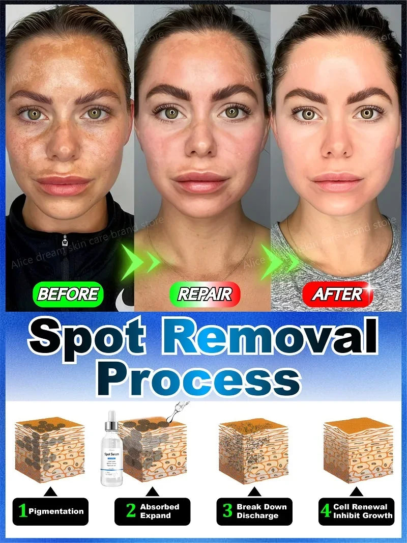 Toral Sérum Anti-Taches – Cible et Corrige Tous les Types de Pigmentation