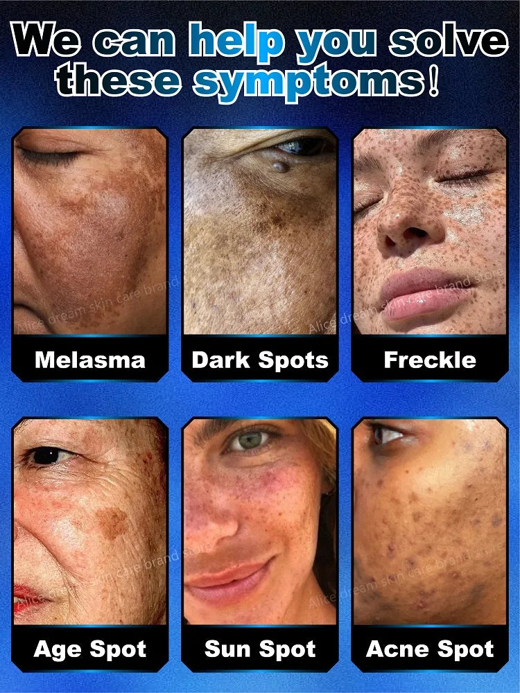 Toral Sérum Anti-Taches – Cible et Corrige Tous les Types de Pigmentation