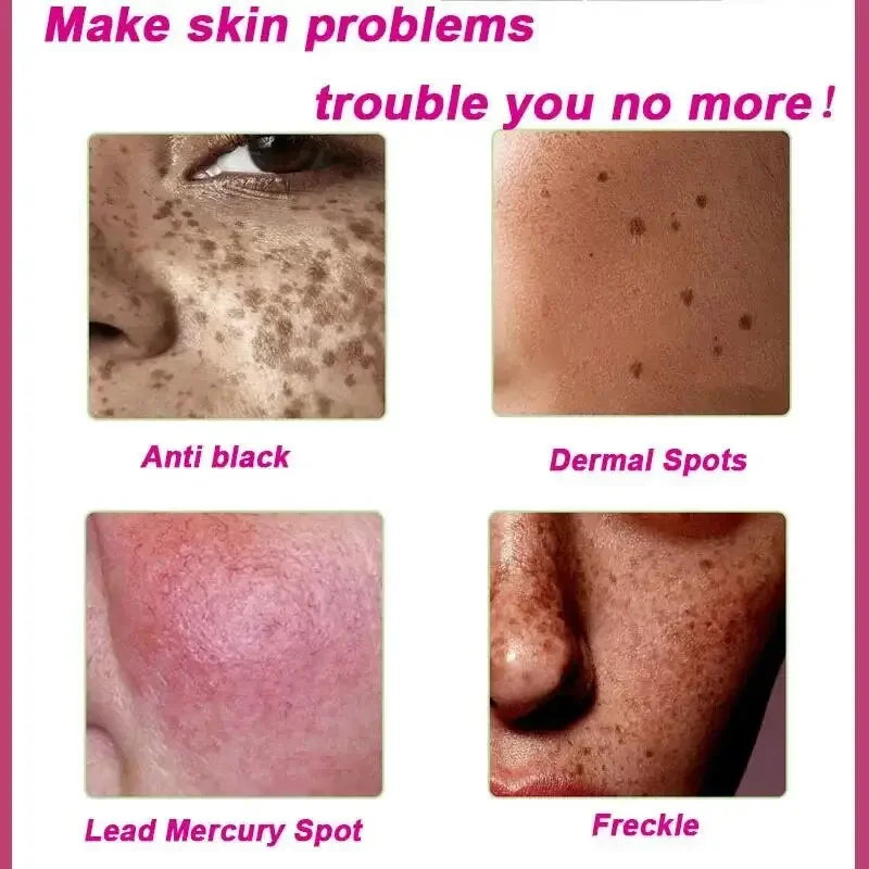 Crème visage éclaircissante – Taches, mélasma & anti-âge
