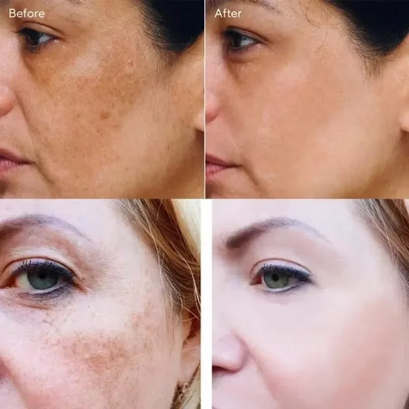 Crème visage éclaircissante – Taches, mélasma & anti-âge