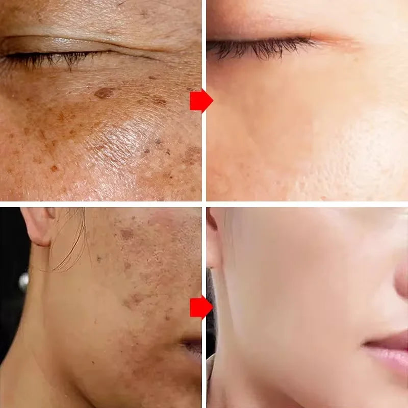 Crème visage éclaircissante – Taches, mélasma & anti-âge