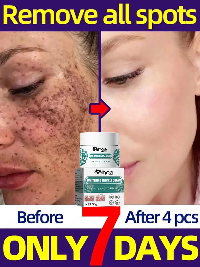 Crème visage éclaircissante – Taches, mélasma & anti-âge