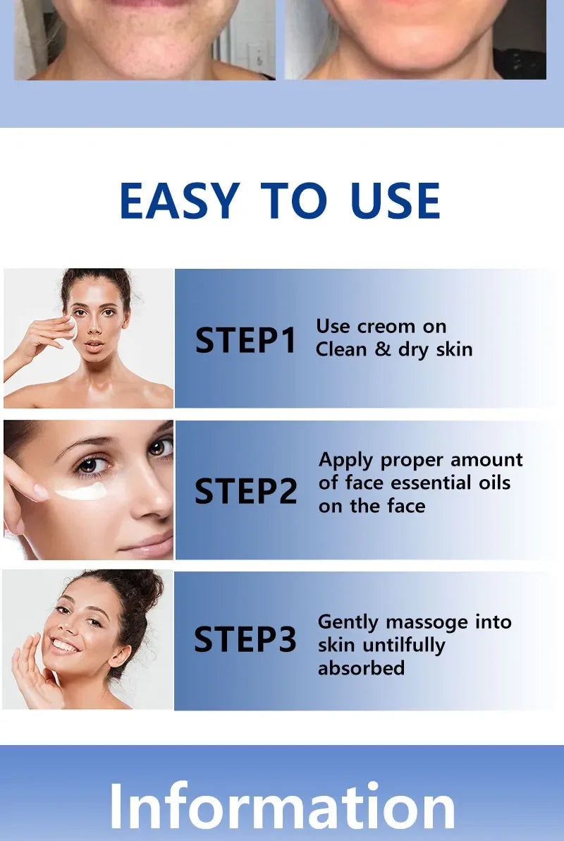 Toral Sérum Anti-Taches – Cible et Corrige Tous les Types de Pigmentation
