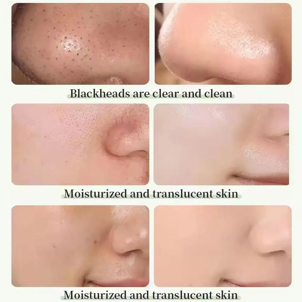 Masque Boue Thé Vert & Aubergine – Anti-Points Noirs & Pores Resserrés.