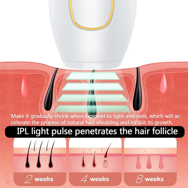 Épilateur laser IPL professionnel maison – Unisexe