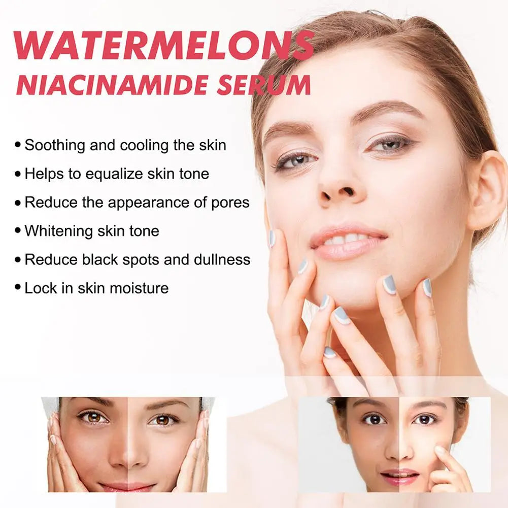Gouttes de rosée Niacinamide, recette lumineuse de pastèque, 40ML, pour la peau lisse, hydratante, avec soin de la peau à l'acide hyaluronique