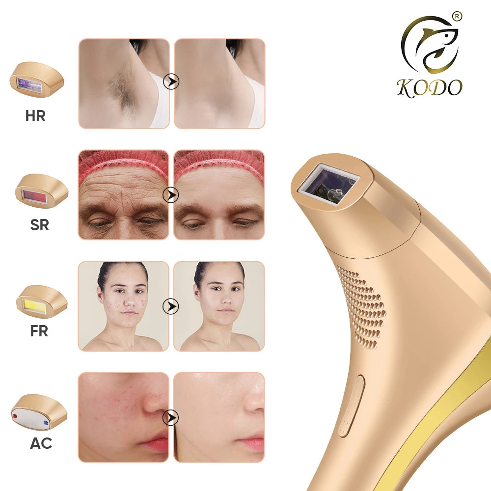 KODO 2025 – Épilateur laser IPL 4-en-1 indolore visage & corps