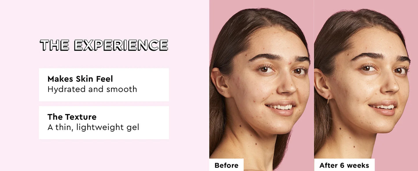 Glow Recette Niacinamide WaterNeutrGlow Gouttes de Rosée, Élimination de la Pigmentation, Sérum Éclaircissant pour le Visage et le Corps, 40ml