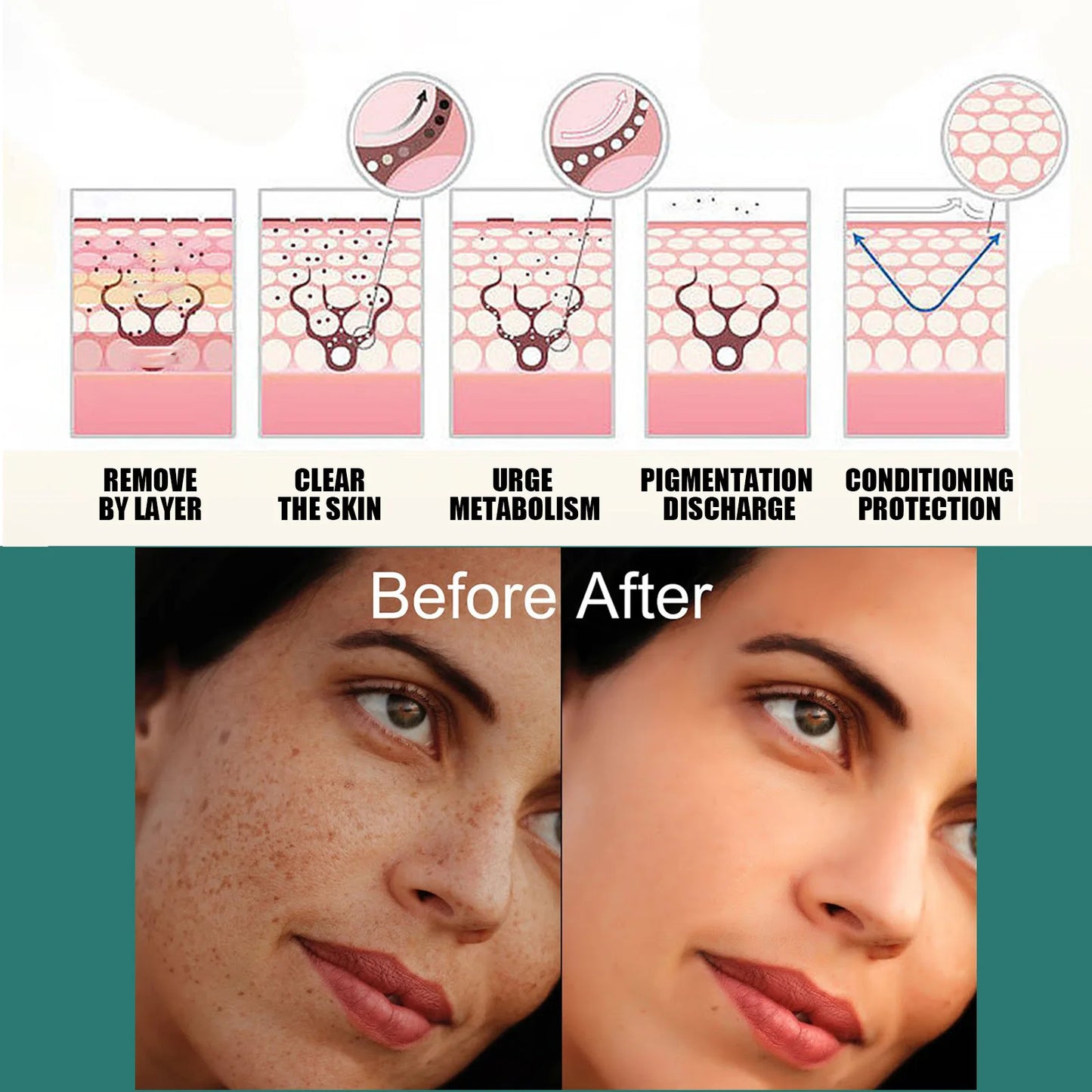 Crème visage éclaircissante – Taches, mélasma & anti-âge