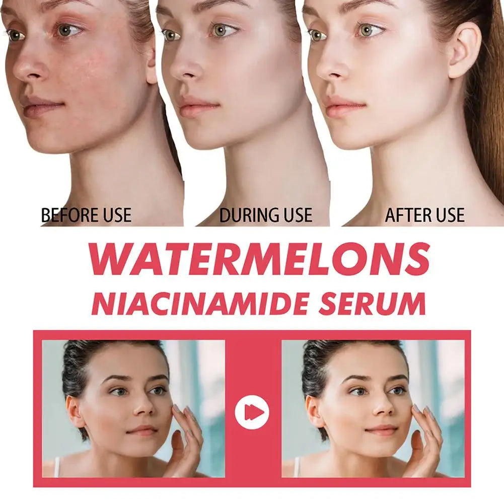 Gouttes de rosée Niacinamide, recette lumineuse de pastèque, 40ML, pour la peau lisse, hydratante, avec soin de la peau à l'acide hyaluronique