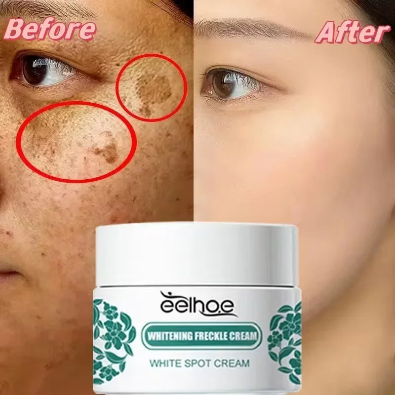 Crème visage éclaircissante – Taches, mélasma & anti-âge