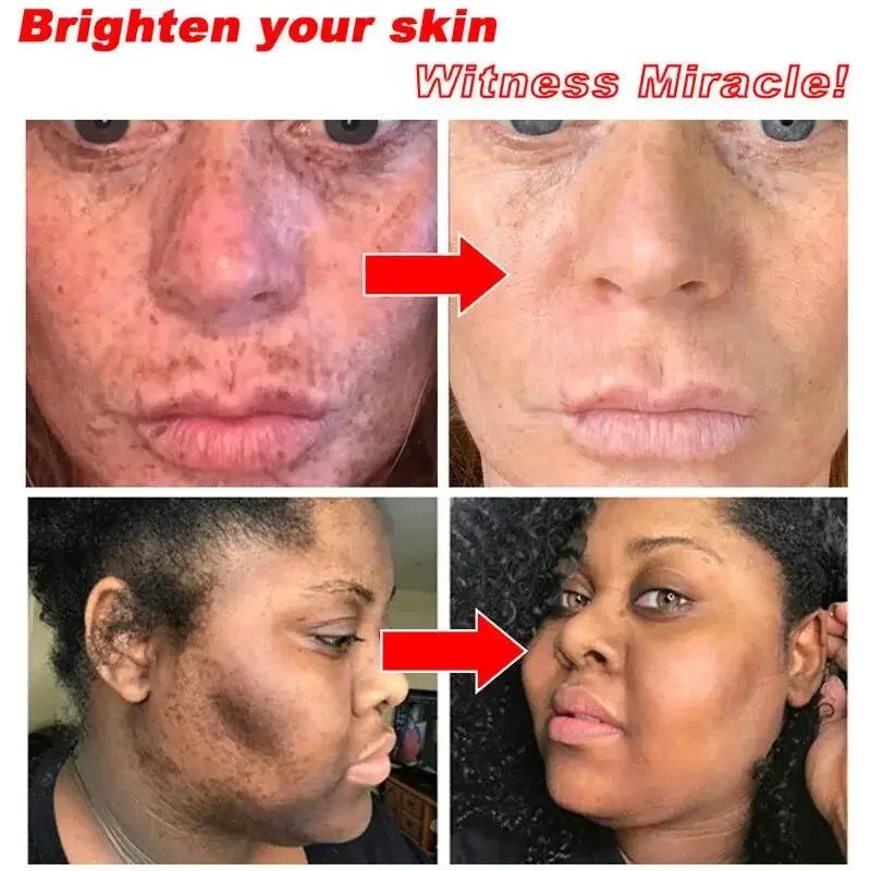 Crème visage éclaircissante – Taches, mélasma & anti-âge