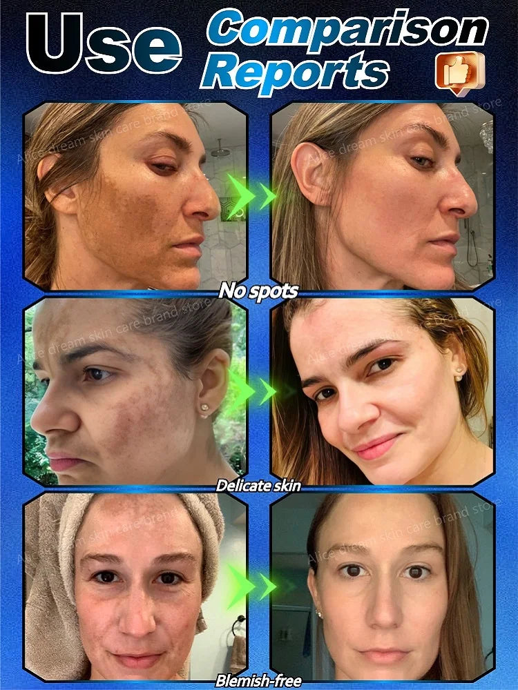 Toral Sérum Anti-Taches – Cible et Corrige Tous les Types de Pigmentation