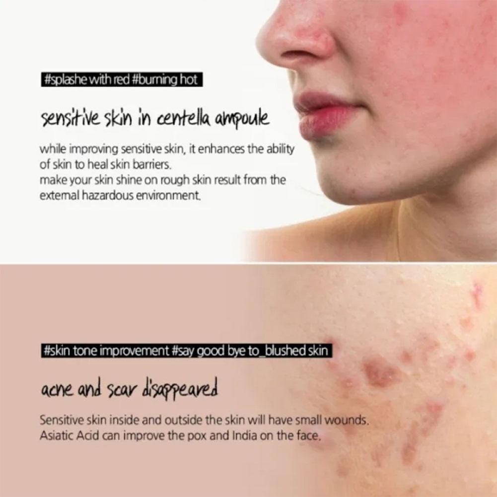 Coffret Visage Centella – Sérum, Crème Solaire & Ampoule.