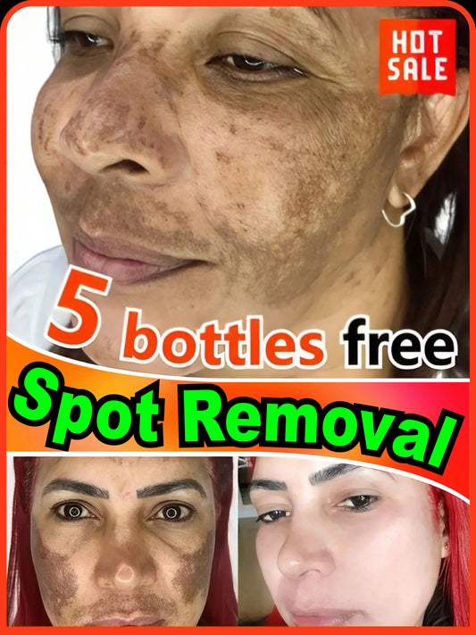 Toral Sérum Anti-Taches – Cible et Corrige Tous les Types de Pigmentation