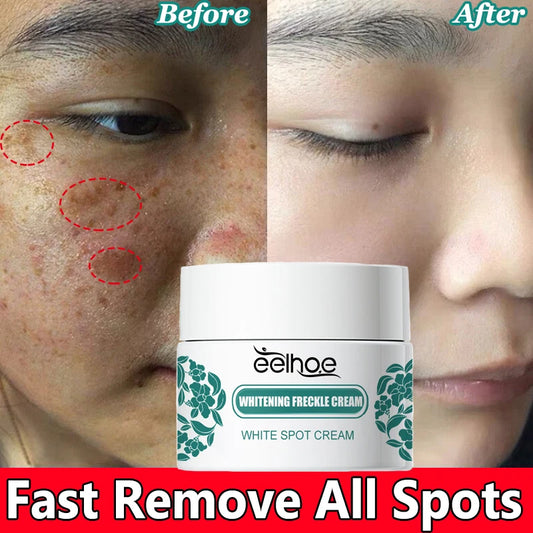 Crème visage éclaircissante – Taches, mélasma & anti-âge